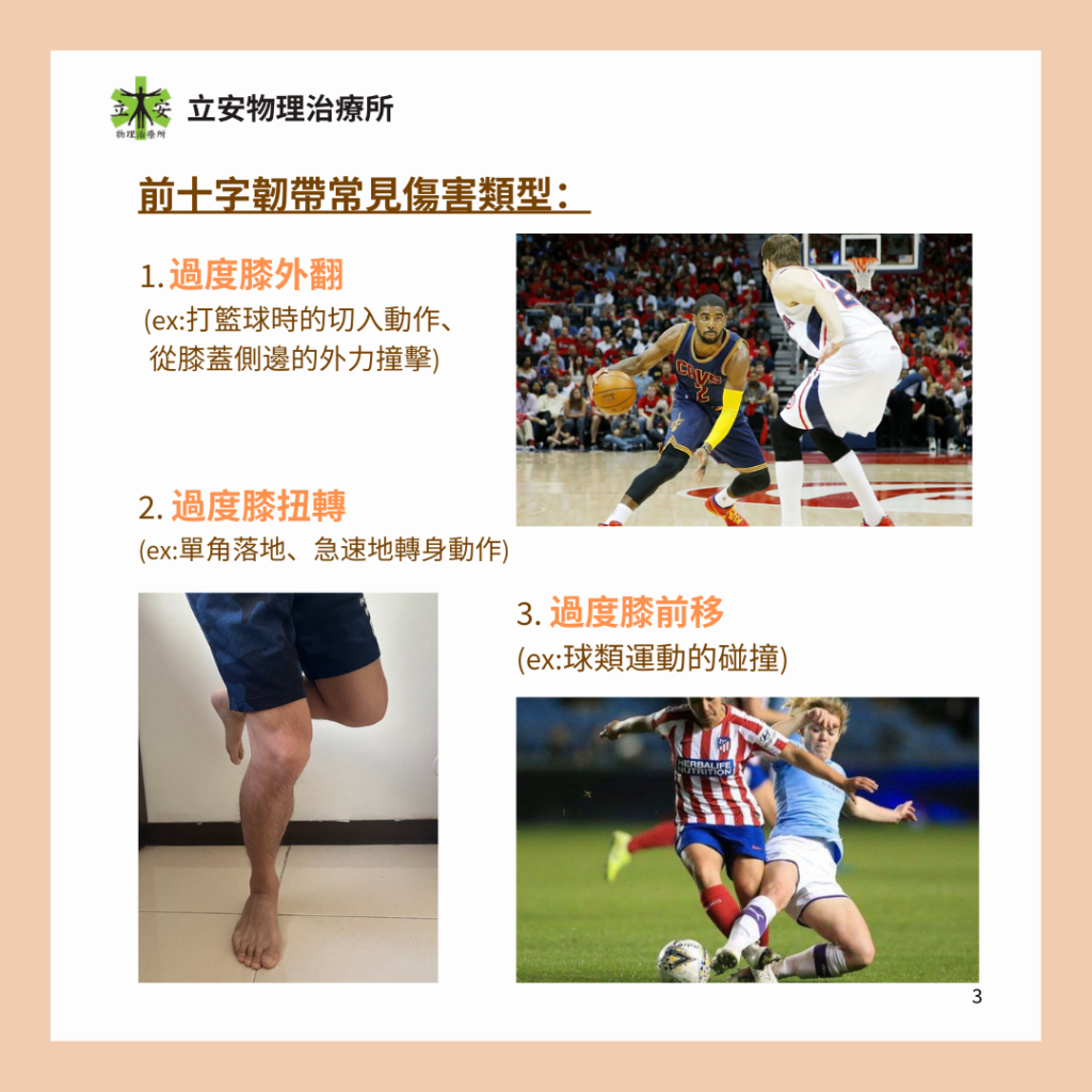 立安小教室:膝蓋前十字韌帶的構造、功能及傷害預防
